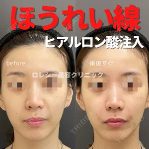 ロレシー美容クリニック 心斎橋駅前院 福留院長医師の症例
