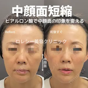ロレシー美容クリニック 心斎橋駅前院 福留院長医師の症例
