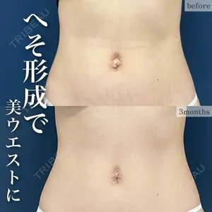 東京シンデレラ美容外科 新宿院 吉原 伯医師の症例