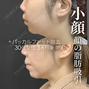 ジョウクリニック 銀座院 重本　譲医師の症例
