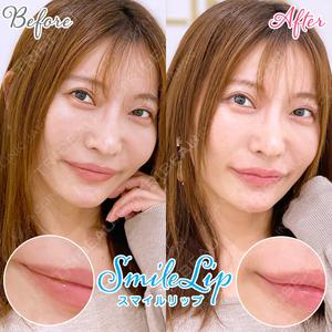 東京銀座A CLINIC デンタルの症例
