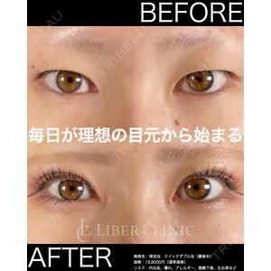 LIBER CLINIC 矢橋 洋一郎医師の症例