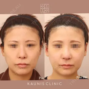 KAUNIS CLINIC（カウニスクリニック） 高野 敏郎医師の症例