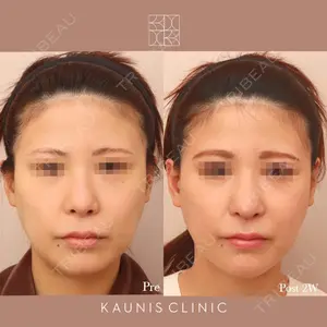 KAUNIS CLINIC（カウニスクリニック） 高野 敏郎医師の症例