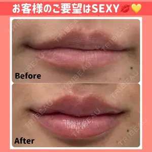 湘南美容クリニック 銀座院の症例