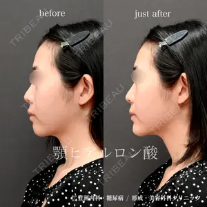豊洲内科・糖尿病 / 形成・美容外科クリニック 澤口 悠医師の症例