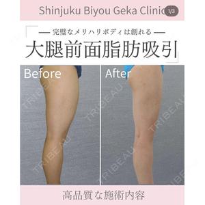 新宿美容外科クリニック 新宿院 井上 淳医師の症例