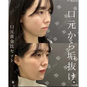 EMMO FACE CLINIC 大宮院 廣松 直樹医師の症例