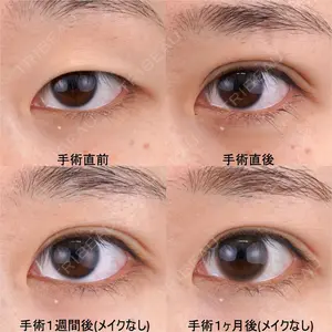 湘南美容クリニック 池袋東口院 赤尾 健医師の症例