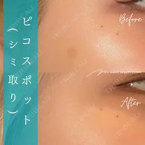 Mavie Beauty Clinic （マヴィービューティークリニック） 三浦梢医師の症例