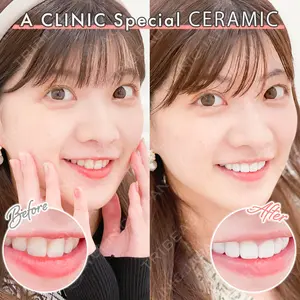 東京銀座A CLINIC デンタルの症例