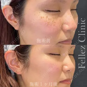 Fellez Clinic【フェルズクリニック】 小野 泰寛医師の症例