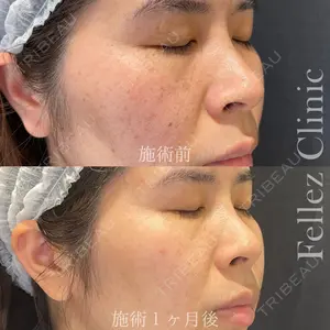 Fellez Clinic【フェルズクリニック】 小野 泰寛医師の症例