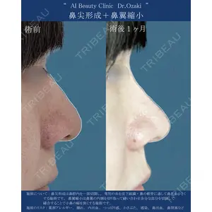 AI Beauty Clinic （エーアイ美容クリニック） 尾崎 宥文医師の症例