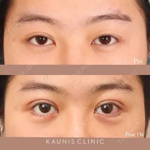 KAUNIS CLINIC（カウニスクリニック） 高野 敏郎医師の症例