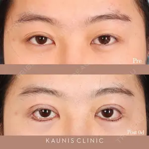 KAUNIS CLINIC（カウニスクリニック） 高野 敏郎医師の症例