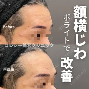 ロレシー美容クリニック 心斎橋駅前院 高田先生医師の症例