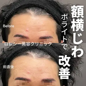 ロレシー美容クリニック 心斎橋駅前院 高田先生医師の症例