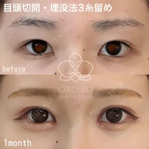 オーキッド美容クリニック東京御徒町 西浦 蘭子医師の症例