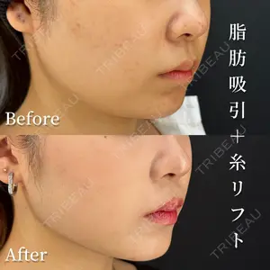 HAAB BEAUTY CLINIC 南青山本院（新院） 金子 雄医師の症例