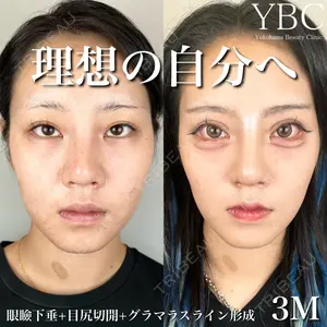 YBC横浜美容外科 大宮院の症例