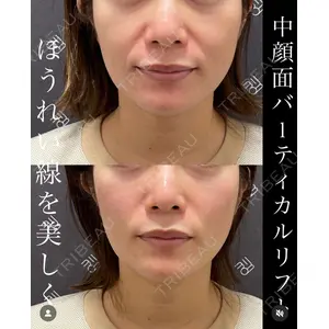 EMMO FACE CLINIC 大宮院 廣松 直樹医師の症例