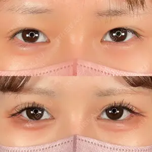 ASTRA BEAUTY CLINICの症例