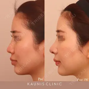 KAUNIS CLINIC（カウニスクリニック） 高野 敏郎医師の症例