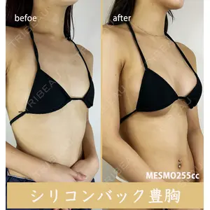 GAYA body design clinic 飯ヶ谷 重来医師の症例