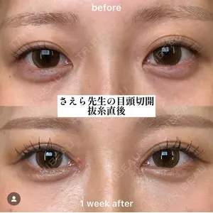 EMMO FACE CLINIC 大阪梅田院 山﨑 冴羅医師の症例