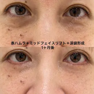 エターナル美容クリニックの症例