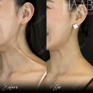 HAAB BEAUTY CLINIC 名古屋院の症例