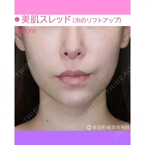 東京形成美容外科 船橋院 弓削田　浩主医師の症例