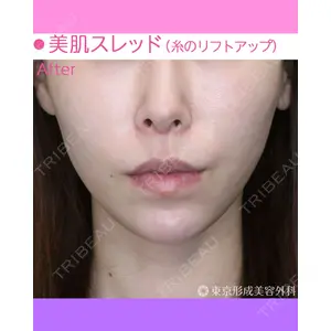 東京形成美容外科 船橋院 弓削田　浩主医師の症例