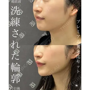EMMO FACE CLINIC 大宮院 廣松 直樹医師の症例