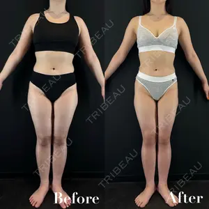 HAAB BEAUTY CLINIC 名古屋院の症例