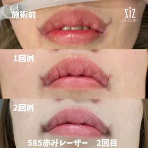 ziz CLINICの症例