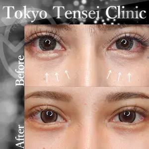 Tokyo Tensei Clinic 新宿院の症例