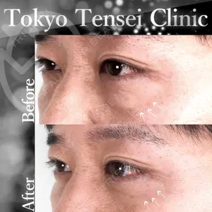 Tokyo Tensei Clinic 新宿院 辻 大成医師の症例