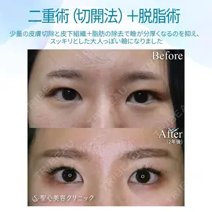 聖心美容クリニック 福岡院 美原 寿之医師の症例