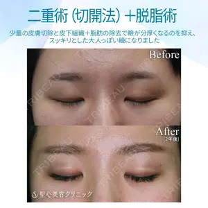 聖心美容クリニック 福岡院 美原 寿之医師の症例