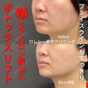 ロレシー美容クリニック 心斎橋駅前院 高田先生医師の症例
