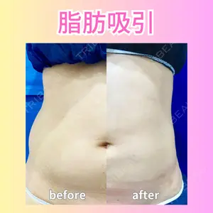 アムルーズ美容外科クリニック 横浜院の症例