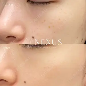 NEXUS CLINICの症例