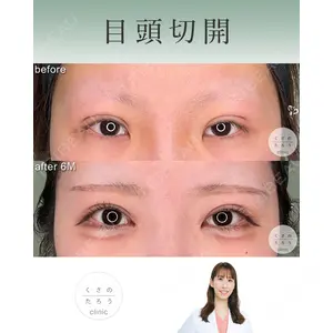 くさのたろうクリニック 立雅恵医師の症例