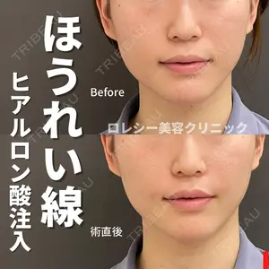 ロレシー美容クリニック 心斎橋駅前院 福留院長医師の症例