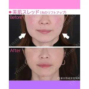 東京形成美容外科 船橋院 山崎 修吾医師の症例