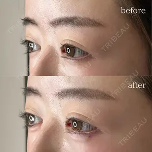 美容皮膚科エルムクリニック 福岡院の症例
