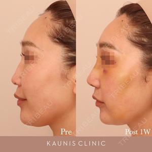 KAUNIS CLINIC（カウニスクリニック） 高野 敏郎医師の症例