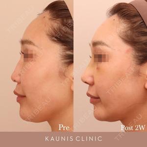 KAUNIS CLINIC（カウニスクリニック） 高野 敏郎医師の症例
